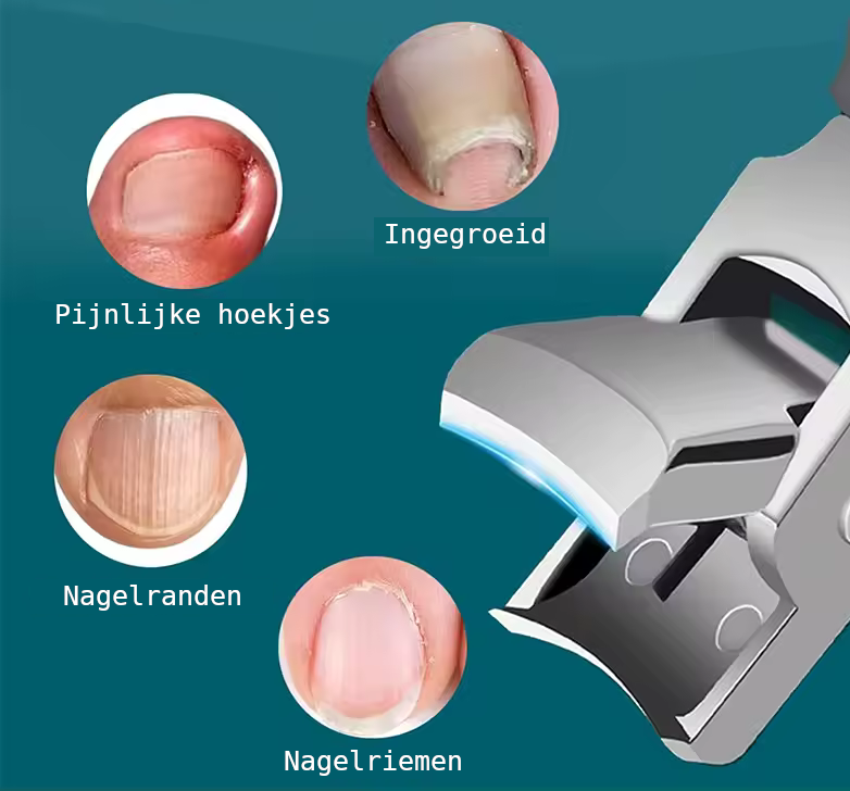 ClearCut™ – Probleemnagels? Knip ze moeiteloos.